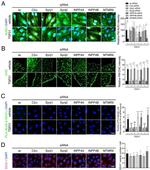 Clathrin Heavy Chain Antibody in Immunocytochemistry (ICC/IF)