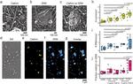 Clathrin Heavy Chain Antibody in Immunomicroscopy (IM)