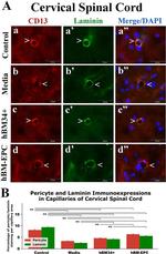 CD13 Antibody in Immunohistochemistry (IHC)