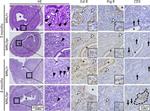 Progesterone Receptor Antibody in Immunohistochemistry (IHC)