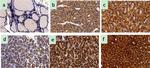 Calcium Sensing Receptor Antibody in Immunohistochemistry (IHC)