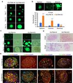 Cytokeratin 14 Antibody in Immunohistochemistry (Paraffin) (IHC (P))