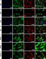 Cytokeratin 14 Antibody in Immunocytochemistry (ICC/IF)