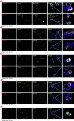 MUC5AC Antibody in Immunohistochemistry (IHC)