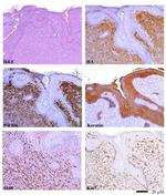 Cytokeratin Pan Antibody in Immunohistochemistry (IHC)