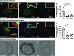 Estrogen Receptor alpha Antibody in Immunohistochemistry (IHC)