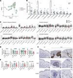 CD8 Antibody in Immunohistochemistry (IHC)