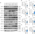 Phospho-PERK (Thr980) Antibody in Western Blot (WB)