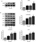 Phospho-PERK (Thr980) Antibody in Western Blot (WB)