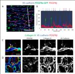 CD140b (PDGFRB) Antibody in Immunohistochemistry (IHC)