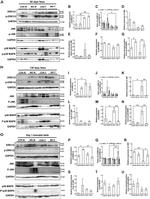 Phospho-p38 MAPK (Thr180, Tyr182) Antibody in Western Blot (WB)