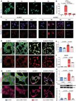 MMP9 Antibody in Mass Spectrometry (MS)