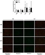 Tenascin C Antibody in Immunohistochemistry (IHC)