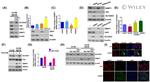 YAP1 Antibody in Western Blot (WB)