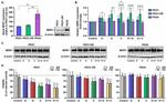 P-Glycoprotein Antibody in Western Blot (WB)