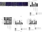 CD31 Antibody in Western Blot (WB)