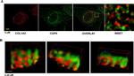 COPII Antibody in Immunocytochemistry (ICC/IF)