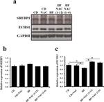 SREBP1 Antibody in Western Blot (WB)