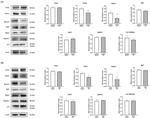 Parkin Antibody in Western Blot (WB)