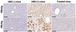 Hepatitis B Virus Surface Ad/Ay Antibody in Immunohistochemistry (IHC)