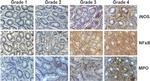 Myeloperoxidase Antibody in Immunohistochemistry (IHC)