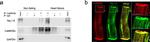 CaMKII delta Antibody in Immunoprecipitation (IP)