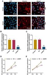 Vimentin Antibody in Immunocytochemistry (ICC/IF)