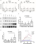 beta-1 Adrenergic Receptor Antibody in Western Blot (WB)