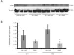 gamma Synuclein Antibody in Western Blot (WB)