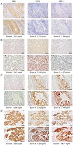 TFF1 Antibody in Immunohistochemistry (IHC)