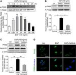 Phospho-PKM2 (Ser37) Antibody in Western Blot (WB)