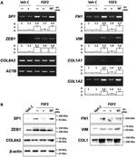 ZEB1 Antibody in Western Blot (WB)