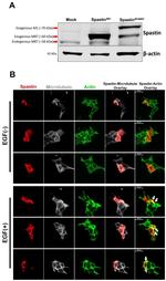 Spastin Antibody in Western Blot (WB)