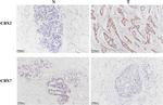 CBX7 Antibody in Immunohistochemistry (Paraffin) (IHC (P))