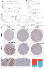 CRHBP Antibody in Immunohistochemistry (IHC)