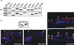 TYRP1 Antibody in Immunohistochemistry (IHC)