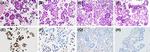 TRPS1 Antibody in Immunohistochemistry (IHC)