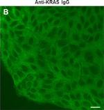 Rabbit IgG (H+L) Cross-Adsorbed Secondary Antibody in Immunocytochemistry (ICC/IF)