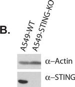 Rabbit IgG (H+L) Secondary Antibody in Western Blot (WB)