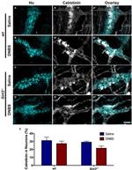 HuC/HuD Antibody in Immunohistochemistry (IHC)