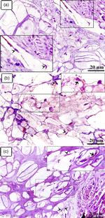 CD117 (c-Kit) Antibody in Immunohistochemistry (IHC)