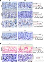 CD127 Antibody in Immunohistochemistry (IHC)