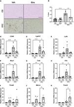 Galectin 3 Antibody in Immunohistochemistry (Paraffin) (IHC (P))