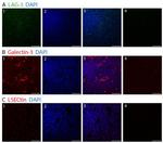 Galectin 3 Antibody in Immunohistochemistry (Paraffin) (IHC (P))