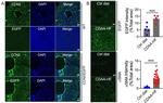 CTGF Antibody in Immunohistochemistry (IHC)