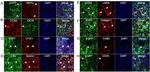 CTGF Antibody in Immunohistochemistry (IHC)