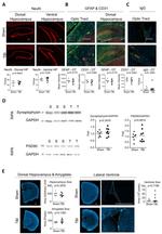 GFAP Antibody in Immunohistochemistry (IHC)