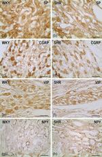 CGRP Antibody in Immunohistochemistry (IHC)