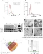 TSG101 Antibody in Western Blot (WB)