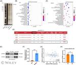 SPTBN1 Antibody in Western Blot (WB)